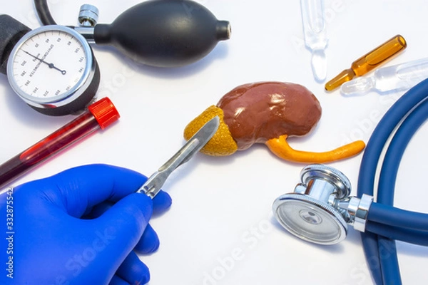 Fototapeta Concept photo of adrenal surgery, operation of adrenalectomy or removal. Doctor with scalpel in hand makes incision in figure of human adrenal, which is located near medical toolkit - stethoscope