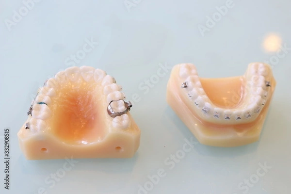 Obraz 矯正装置説明用模型