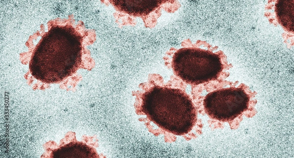 Obraz Covid-19, Sars-Cov-2, Coronavirus realistisch unter dem Mikroskop