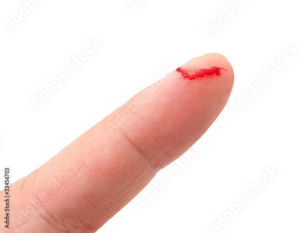 Obraz Bleeding from the cut finger