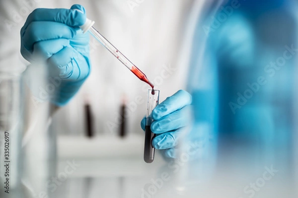 Fototapeta scientist holding blood test tube, lab testing for medication