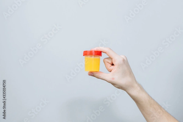 Fototapeta Bank with the analysis of urine, pills and diseases. Laboratory