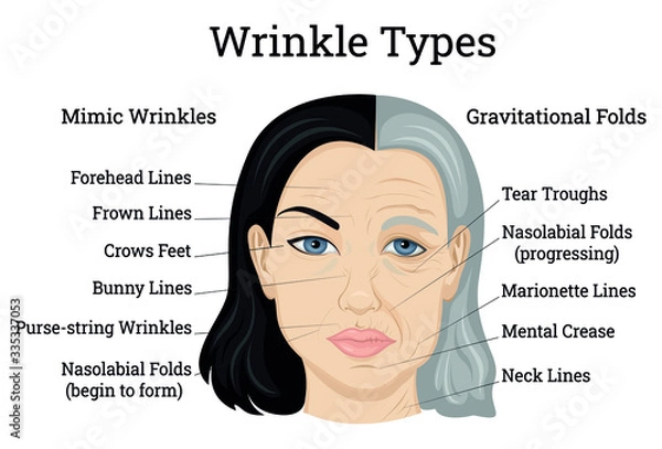 Fototapeta Wrinkle Types Illustration