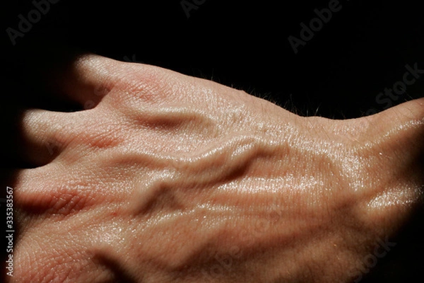 Fototapeta dorsal of a sweaty hand with many veins on a black background