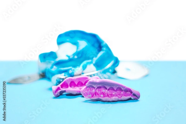 Fototapeta Two dental impressions on a white and blue background. The imprint of the tooth row of high precision and bite registration pieces