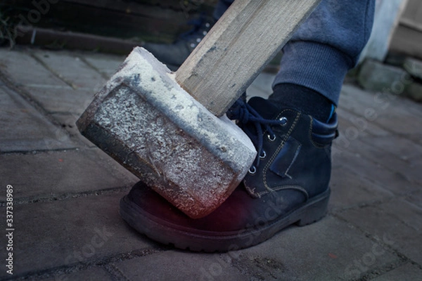 Obraz hammer hit his leg. pain in the ankle