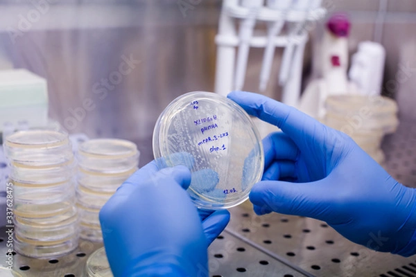 Obraz Growing bacteria to create CAR therapy - the novel method for leukemia, lymphoma therapy, and also could be tested for severe covid-19 tratment