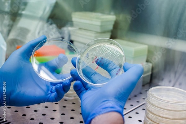 Fototapeta Growing bacteria to create CAR therapy - the novel method for leukemia, lymphoma therapy, and also could be tested for severe covid-19 tratment