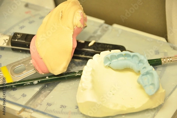 Obraz 歯科技工物