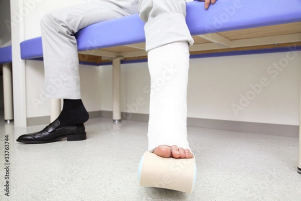 Fototapeta 骨折した男性患者の足