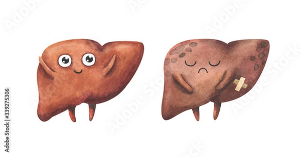 Fototapeta Liver. Healthy and diseased organs. Watercolor illustration in children's style. Characters isolated on a white background. Brown. Cartoon anatomy.
