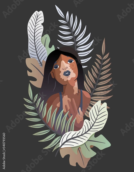 Obraz Vector unusual illustration of a dark-skinned vitiligo girl. Tropical style. Light spots on the skin, unusual skin, body positive. Fashionable picture for articles, web sites, t-shirt design.