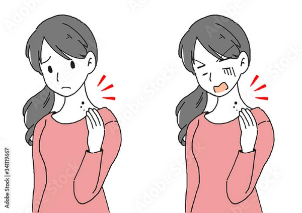 Fototapeta ホクロに悩む女性のイラスト