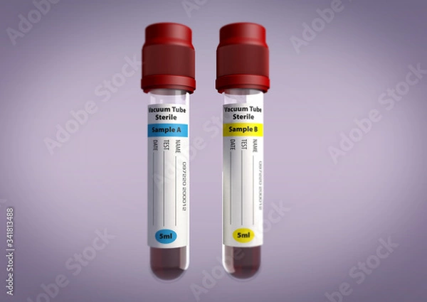 Obraz Blood sample viles