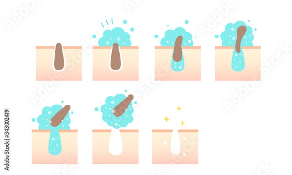 Fototapeta 毛穴の汚れ（角栓）をクレイジング泡がすっきりとりのぞいて綺麗になった肌のイラスト・美容