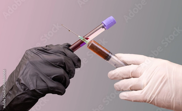 Fototapeta The vaccine against the Covid-19 virus or Coronavirus. Two hands in black and white disposable gloves holding a vaccine and a test tube with blood sample, form a cross