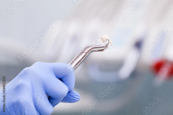 Obraz Tooth extraction