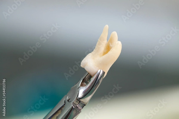 Obraz Tooth extraction