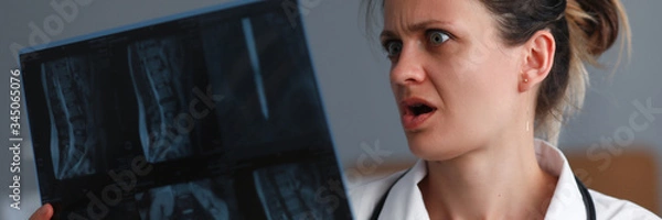 Obraz Portret doświadczonego, zaskoczonego pediatry trzymającego skiagram osoby niezdrowej. Doktor patrzy na pstryknięcie z przerażeniem. Koncepcja opieki zdrowotnej i medycyny