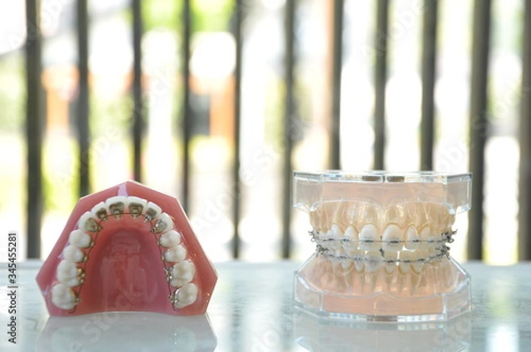 Obraz 歯列模型