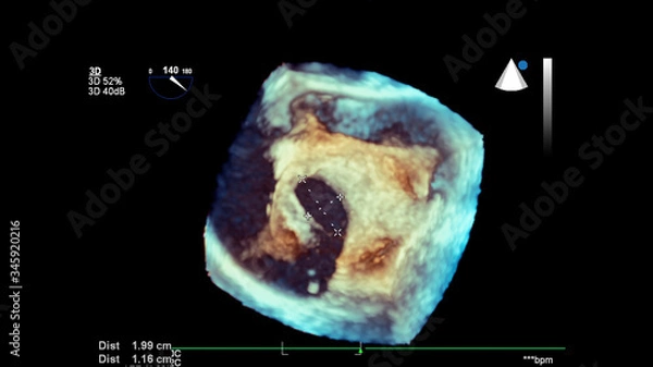 Fototapeta 3D image of the heart during transesophageal ultrasound of the heart.