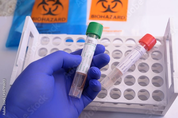 Obraz covid 19 specimen collection kit