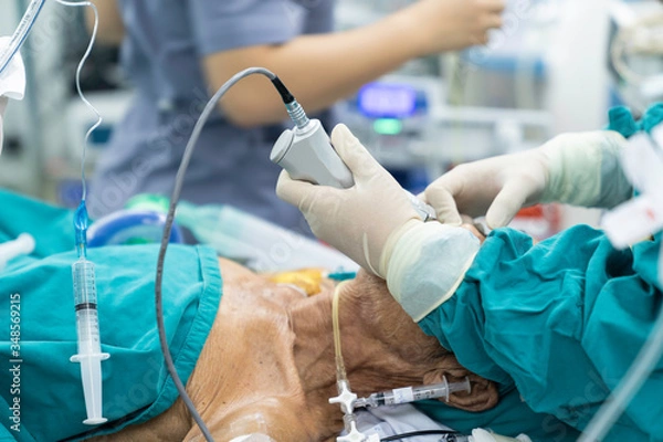 Obraz doctor use video assist laryngoscope to intubate endotracheal tube