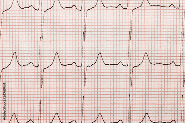 Fototapeta Cardiogram close-up