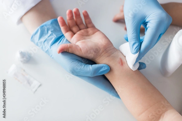 Fototapeta doctor treats a wound to a child, disinfection of a cut on a person, first aid to a child. Top view.