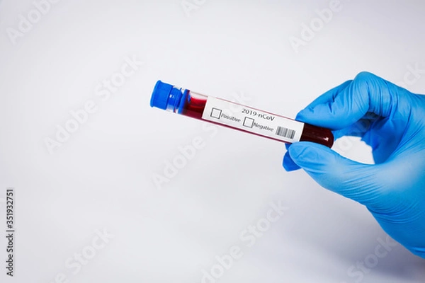 Fototapeta Hand holds a test tube containing a blood negative sample, test tube with blood for Covid-19 (coronavirus) analyzing. Laboratory testing patient’s blood. Blue nitrile glove.