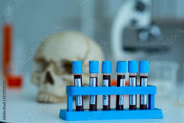 Obraz human fluid sample in small glass test tube with sign COVID-19 virus lebel and blur background of  the skull in clinical science laboratory