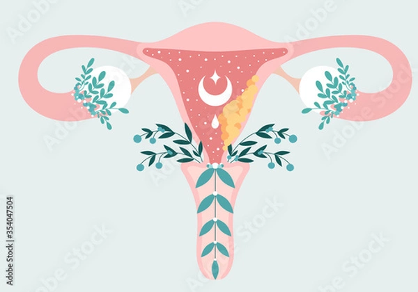 Obraz Women health. Floral Infographic of Endometrial Cancer - Carcinoma. Patient-friendly scheme of Gynecological cancerous tumor. Oncology in Female - Neutral medical diagram uterus and appendages