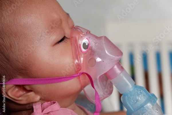 Obraz Sick boy inhalation therapy by the mask of inhaler. Boy is sick with Respiratory Syncytial Virus. Patient Boy use inhalation with Nebulizer mask at hospital. The baby are spraying bronchodilators .
