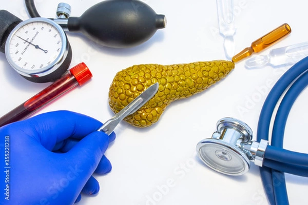 Fototapeta Concept photo of pancreas surgery, operation of gland resection or pancreatectomy. Doctor with scalpel in hand makes incision in figure of human pancreas, which is located near medical toolkit