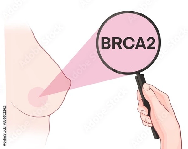 Fototapeta Variants in the BRCA2 gene are associated with an increased risk of developing breast cancer