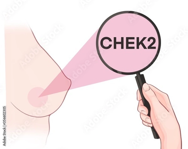 Fototapeta Variants in the CHEK2 gene are associated with an increased risk of developing breast cancer