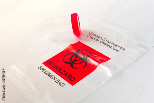 Obraz Biohazard bag with plastic bottle for sputum collection. Concept of lab test for diagnosis of coronavirus infection. Selective focus