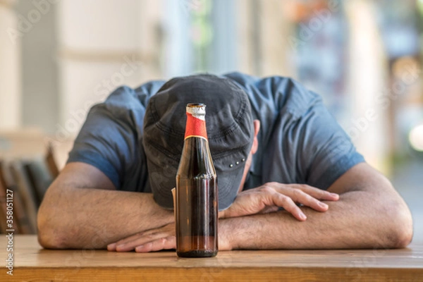 Obraz Pensive and sad man with bowed head sitting holding a bottle of beer outside a bar. Selective focus