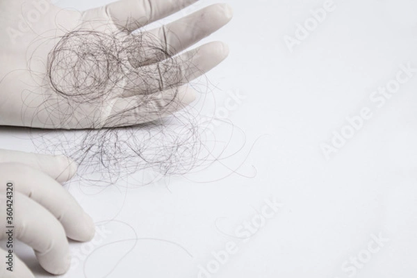 Fototapeta Hair experts wear gloves on both sides and  pick up hair fall for check up on white background. With copy space. Hair fall problem concept.