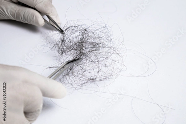 Fototapeta Hair loss specialist, wearing gloves, using forcep to pick up hair for examination. On white background with copy space.