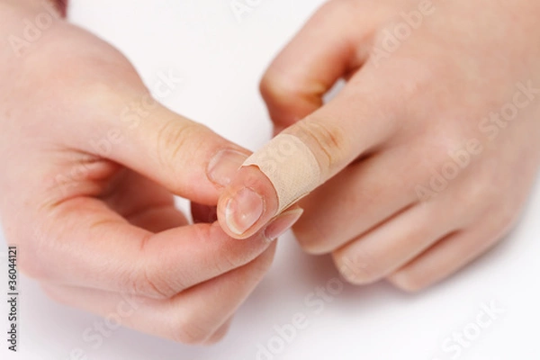Fototapeta 指の怪我