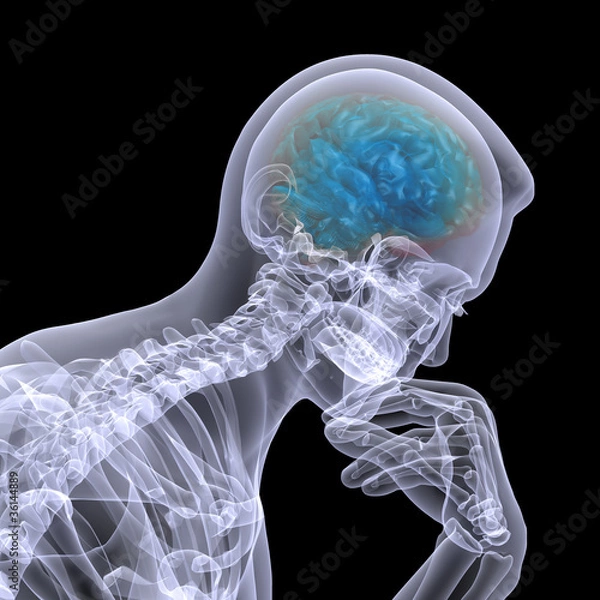 Obraz Skeleton X-Ray - Thinker