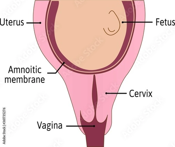 Fototapeta Cervix is not effaced. First stage of delivery process. cervix is tightly closed and protected. Medical vector illustration