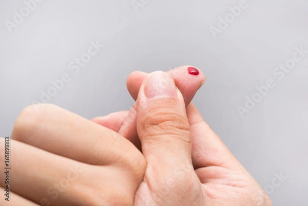 Fototapeta Blood drop on fingertip prepare for checking the glucose level with a glucometer for examining diabetes mellitus.