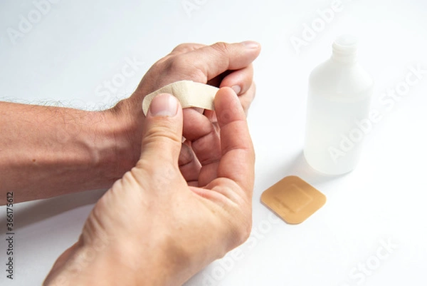Fototapeta disinfecting the wound on the hand and applying a patch