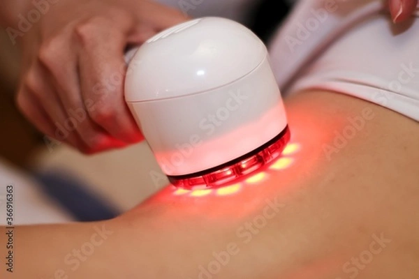 Fototapeta beauty machine working on problem areas