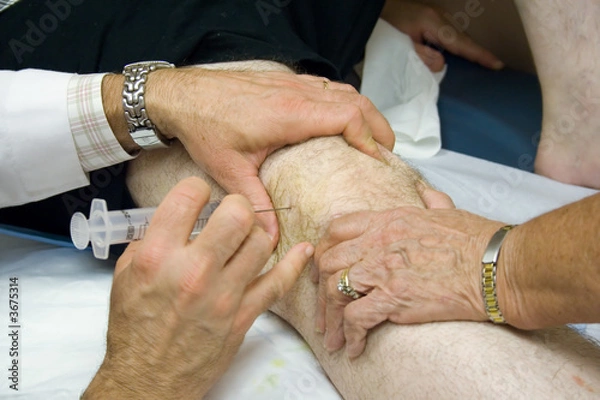 Fototapeta Doctor Giving Injection in the Knee of a Patient