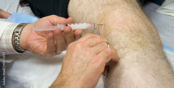 Obraz Doctor Giving Injection in the Knee of a Patient
