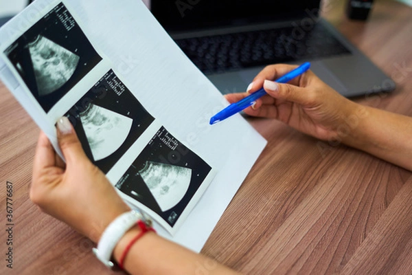 Fototapeta The doctor holds an ultrasound scan of a pregnant girl in the hand