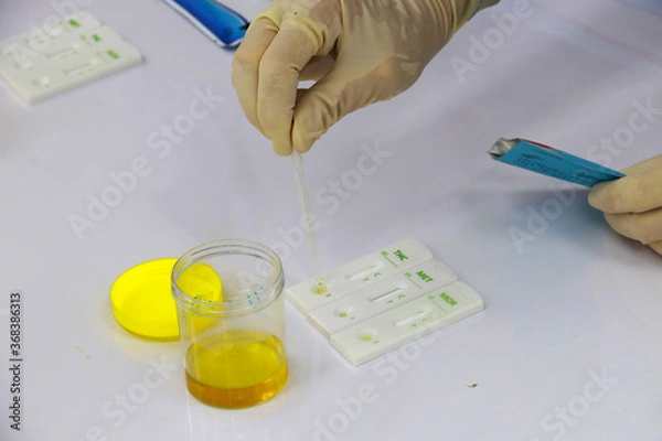 Obraz Substance Abuse Detection by examining the urine, Urine analysis for screening amphetamine, Methamphetamine cassette for search the substance Abuse